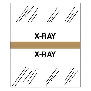Tabbies Medical Chart Index Divider Tab - Printed X-Ray - 100 / Pack - Brown Tab