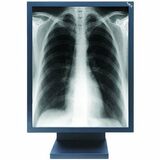NEC Display MultiSync MD21GS-3MP-BKCB2 LCD Monitor