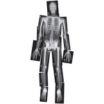 Roylco True To Life Human X-rays Set