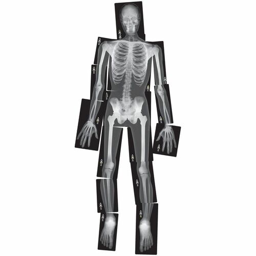 Roylco Human X-Ray - Theme/Subject: Radiology - Skill Learning: Radiography - 4+ - 18 / Pack - Life Science - ROY5911