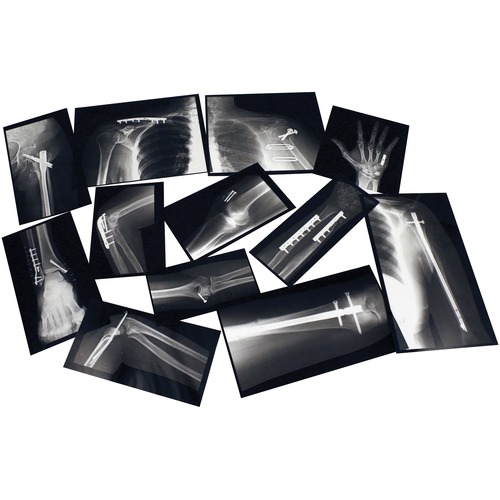 Roylco Fixed Bone X-Ray - Theme/Subject: Radiology - Skill Learning: Anatomy - 5+ - 28 / Pack - Life Science - ROY59255