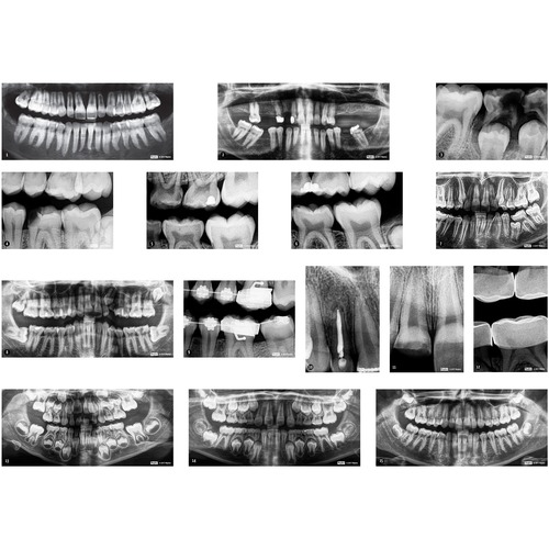 Roylco Dental X-Rays - Theme/Subject: Health - Skill Learning: Dentist - 5+ - 15 / Pack - Life Science - ROY59269