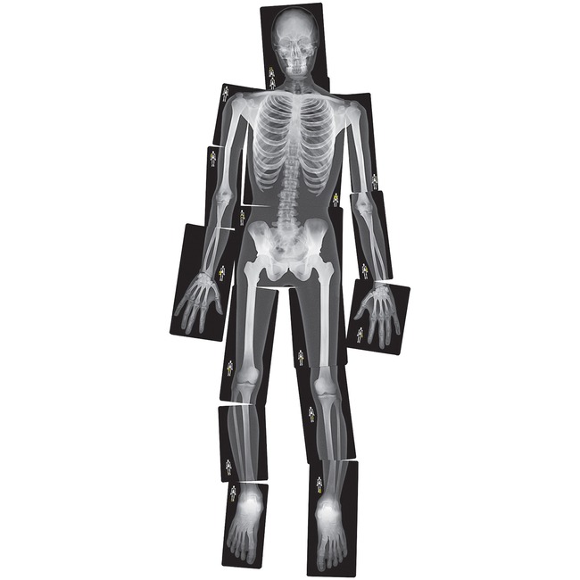 Roylco True to Life Human X-rays Set