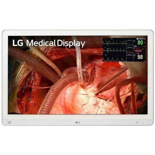 LG 27HQ710S-W 27" Class 4K UHD LED Monitor - 16:9