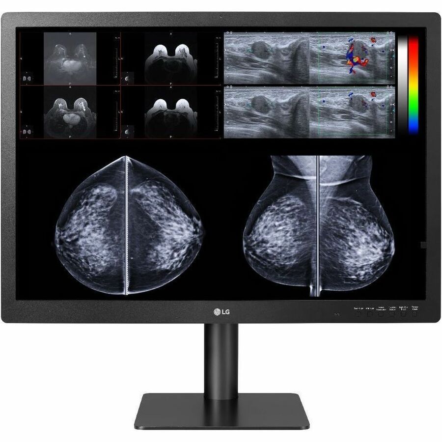 Lenovo 78094614 31" Class 4K UHD LED Monitor - Black