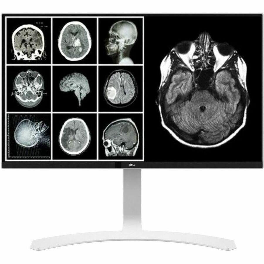 Lenovo 78094615 32" Class 4K UHD LED Monitor - 16:9 - Black
