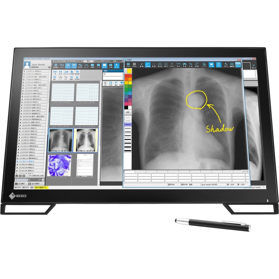 EIZO RadiForce MS236WT-A 23" Class LED Touchscreen Monitor - 16:9 - 11 ms