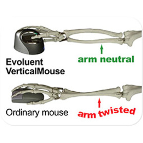 Evoluent VerticalMouse 4 Small Mouse - Optical - Cable - 1 Pack - USB 2.0 - 2600 dpi - Scroll Wheel - 6 Button(s) - 6 Programmable Button(s) - Right-handed Only = ELUVM4S