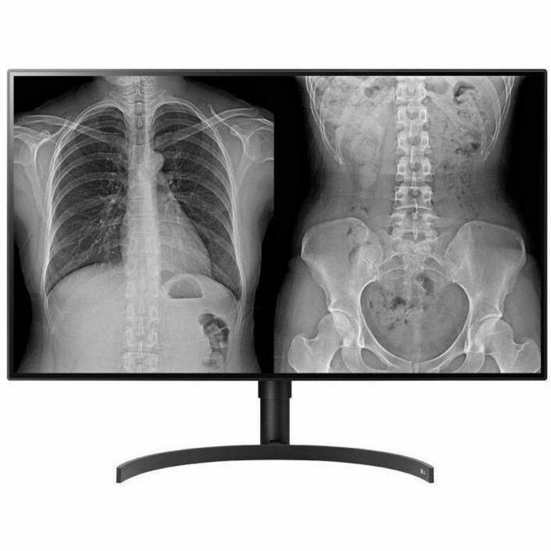 LG 32HL512D-B - LCD MONITOR - FLAT - 3840 X 2160 - 31.5INCH - 5MS RESPONSE TIME