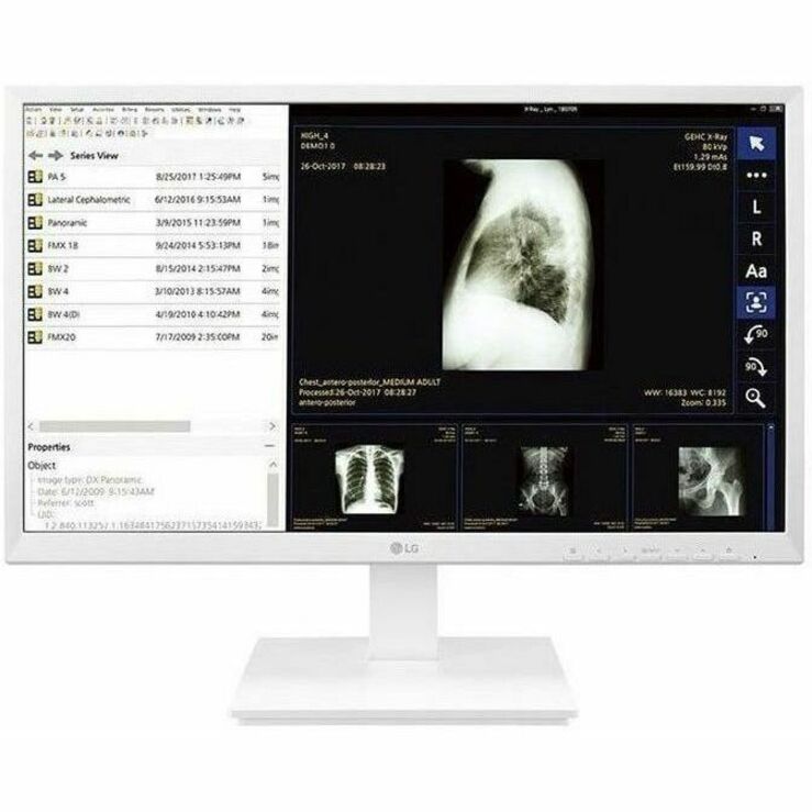 24IN 1929X1080 IPS 5MS