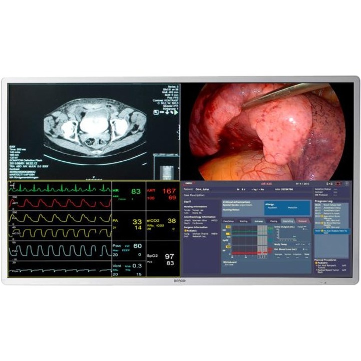 MDSC-8255 LED: 55INCH SURGICAL DISPLAY WITH 4K UHD RESOLUTION, 8MP ULTRA-HIGH RE