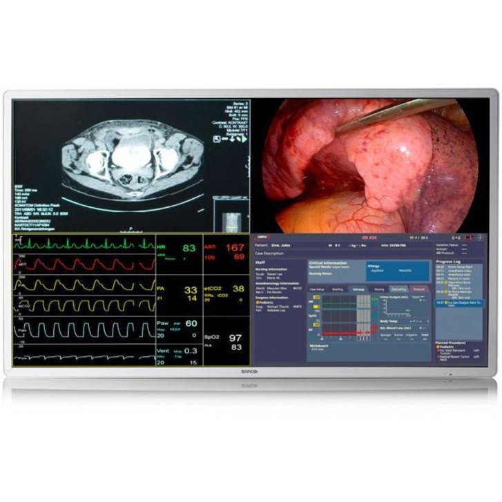 BARCO MDSC-8255 12G 4K UHD LARGE-SCREEN 55INCH SURGICAL DISPLA