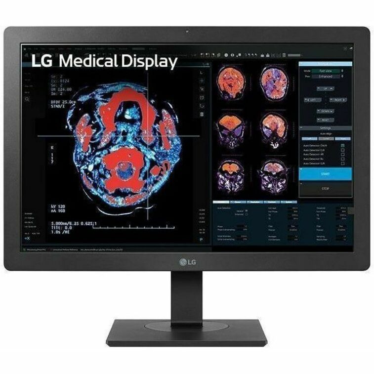 24IN LG 2MP DIAGNOSTIC MONITOR