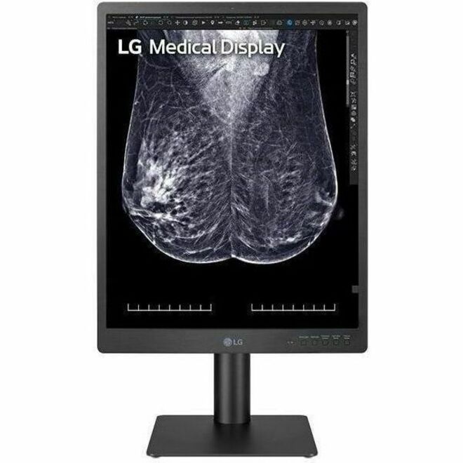 21IN LG MEDICAL IPS 5MP DIAGNOSTIC MONIT