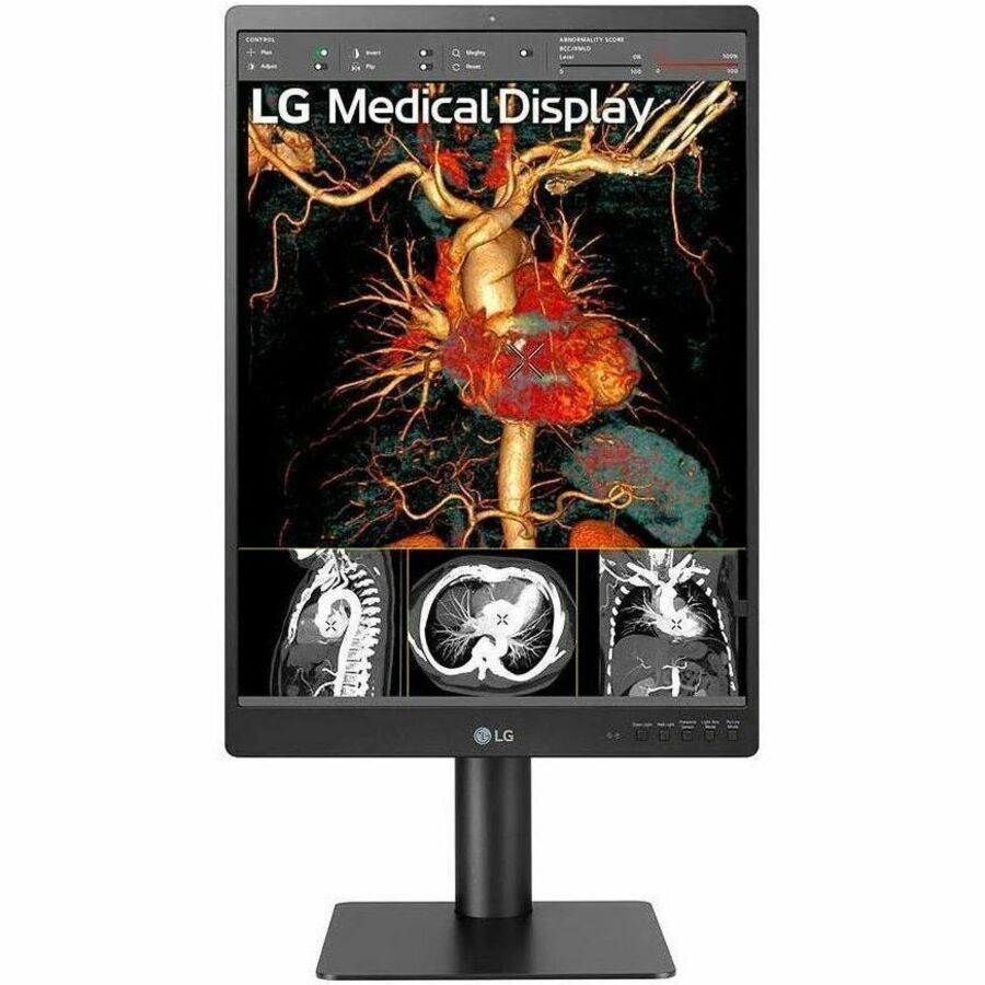 21 LG 3MP DIAGNOSTIC MONITOR