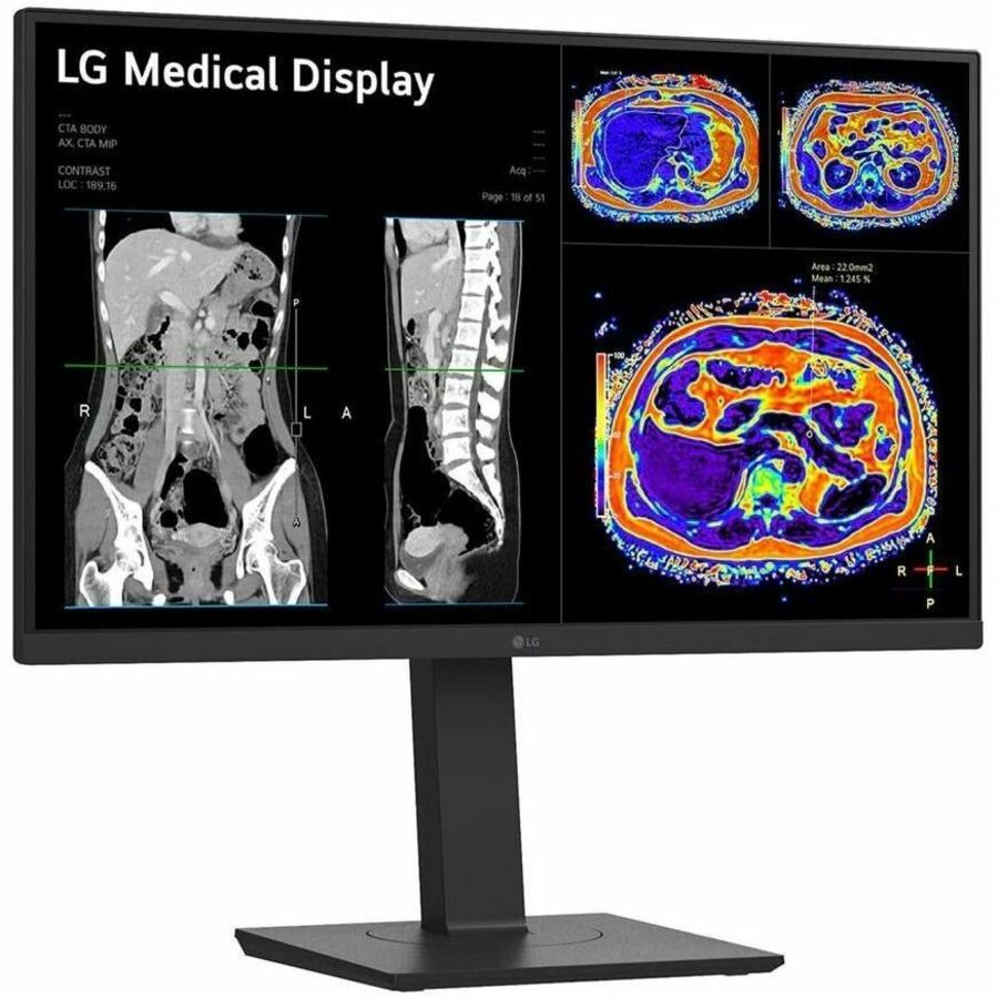27 LG 8MP CLINICAL MONITOR BLACK