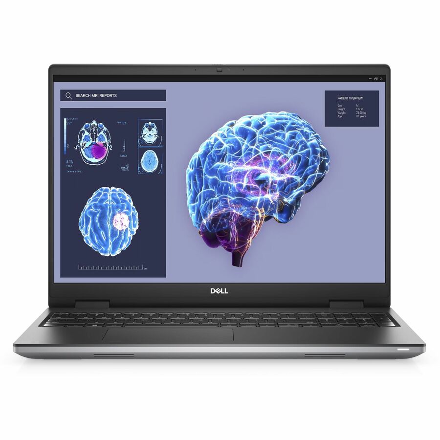 MOBILE PRECISION 7680 CORE_I5_13-13600HX 32GB (2DIMMS) 1TB SS NVIDIA RTX RTX1000