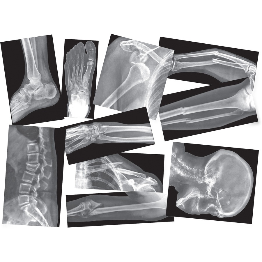 Theme/subject Radiology Roylco Broken Bones X-ray Skill Learning Anatomy 
