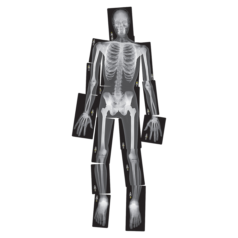 Roylco True To Life Human X-Rays