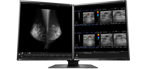 <b>Clear, High Density Images</b></br>The monitor hosts 0.165 mm pixels, realizing a smooth, high-density, high-definition image without graininess.
